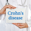 Crohn’s disease life expectancy